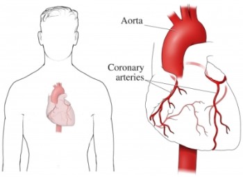 �������� KAWASAKI (10).jpg